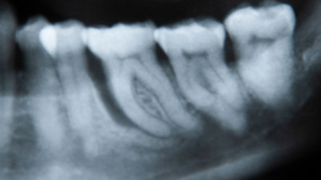 Zahnarztpraxis Dr. Isabel Selmair - München, Schwabing / Parodontitisbehandlung