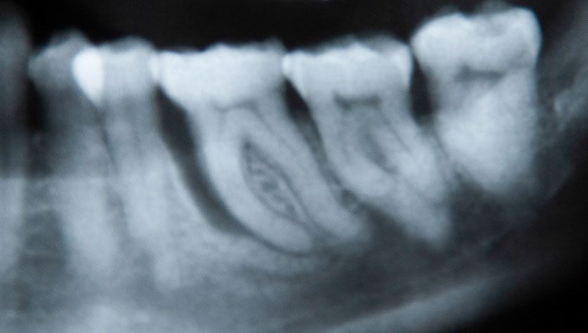 Zahnarztpraxis Dr. Isabel Selmair - München, Schwabing / Parodontitisbehandlung