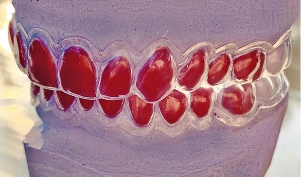 Zahnarztpraxis Dr. Isabel Selmair - München, Schwabing / Ästhetische Rekonstruktionen, Bleaching