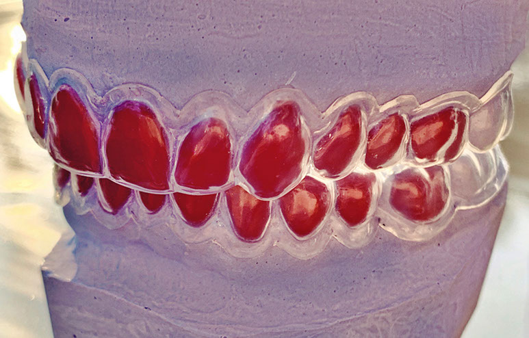 Zahnarztpraxis Dr. Isabel Selmair - München, Schwabing / Ästhetische Rekonstruktionen, Bleaching
