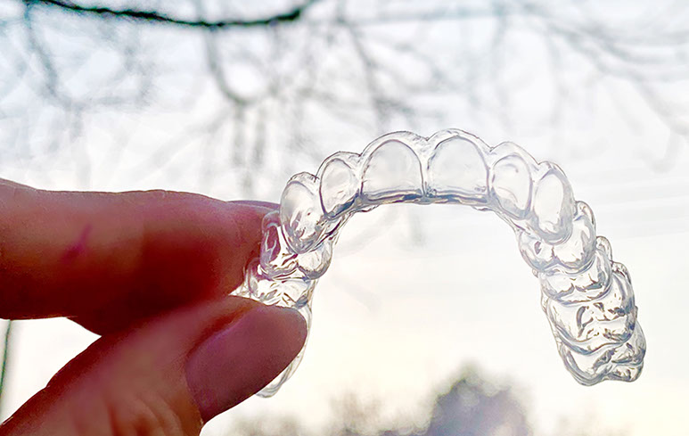 Zahnarztpraxis Dr. Isabel Selmair - München, Schwabing / Ästhetische Rekonstruktionen, Bleaching