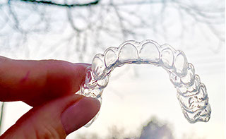 Zahnarztpraxis Dr. Isabel Selmair - München, Schwabing / Ästhetische Rekonstruktionen, Bleaching