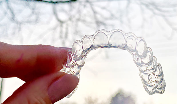 Zahnarztpraxis Dr. Isabel Selmair - München, Schwabing / Ästhetische Rekonstruktionen, Bleaching