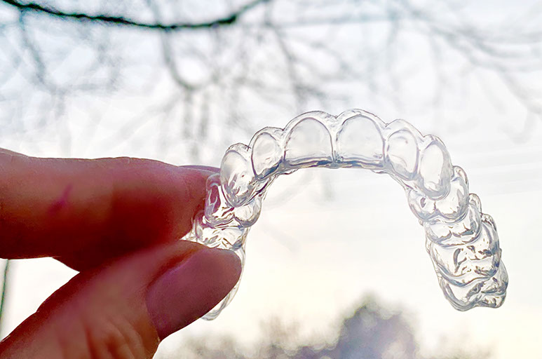 Zahnarztpraxis Dr. Isabel Selmair - München, Schwabing / Ästhetische Rekonstruktionen, Bleaching