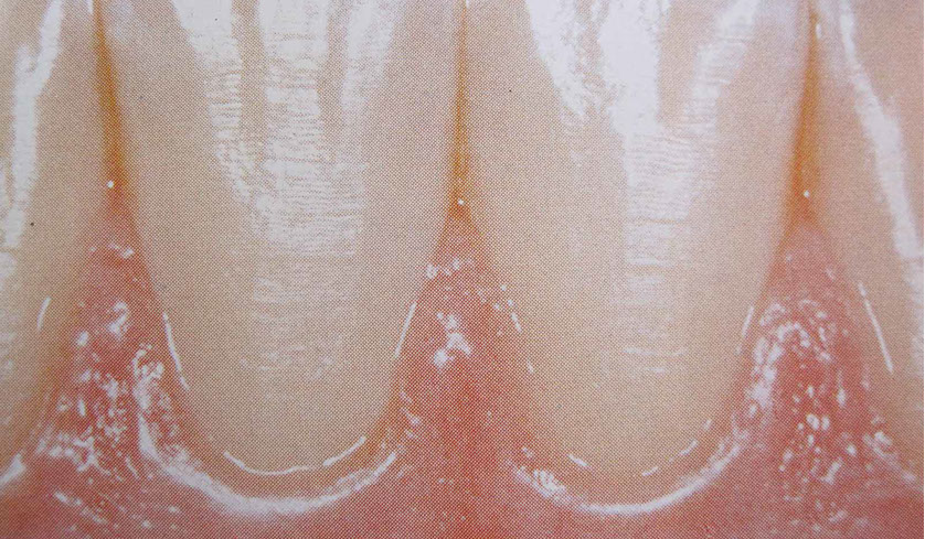 Zahnarztpraxis Dr. Isabel Selmair - München, Schwabing / Parodontitisbehandlung