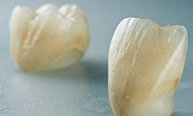 Zahnarztpraxis Dr. Isabel Selmair - München, Schwabing / Zahnersatz, Kronen Brücken