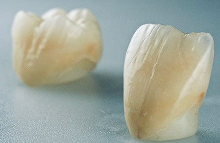 Zahnarztpraxis Dr. Isabel Selmair - München, Schwabing / Zahnersatz, Kronen Brücken