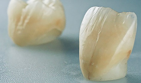 Zahnarztpraxis Dr. Isabel Selmair - München, Schwabing / Alterszahnheilkunde, Zahnersatz