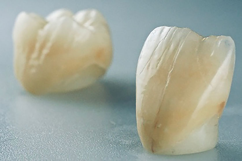 Zahnarztpraxis Dr. Isabel Selmair - München, Schwabing / Alterszahnheilkunde, Zahnersatz