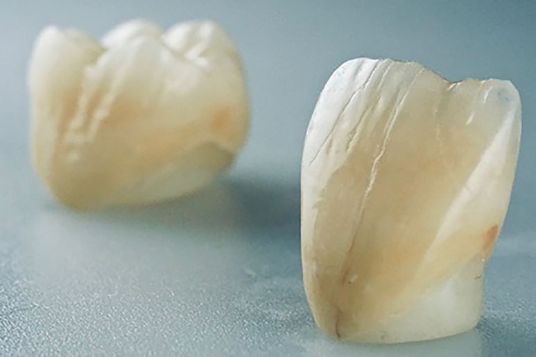 Zahnarztpraxis Dr. Isabel Selmair - München, Schwabing / Alterszahnheilkunde, Zahnersatz