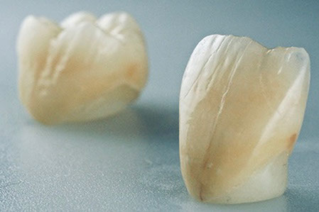 Zahnarztpraxis Dr. Isabel Selmair - München, Schwabing / Zahnersatz, Kronen Brücken