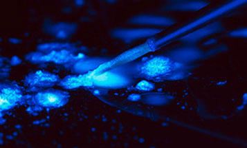 Zahnarztpraxis Dr. Isabel Selmair - München, Schwabing / Zahnersatz, Kronen Brücken