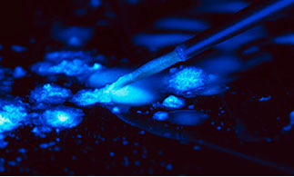 Zahnarztpraxis Dr. Isabel Selmair - München, Schwabing / Zahnersatz, Kronen Brücken