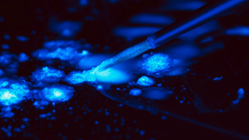 Zahnarztpraxis Dr. Isabel Selmair - München, Schwabing / Zahnersatz, Kronen Brücken