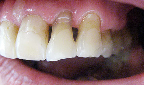 Zahnarztpraxis Dr. Isabel Selmair - München, Schwabing / Alterszahnheilkunde, Zahnersatz