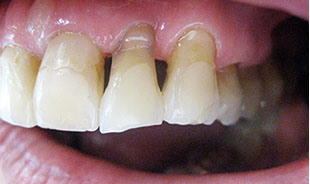 Zahnarztpraxis Dr. Isabel Selmair - München, Schwabing / Alterszahnheilkunde, Zahnersatz