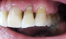 Zahnarztpraxis Dr. Isabel Selmair - München, Schwabing / Alterszahnheilkunde, Zahnersatz