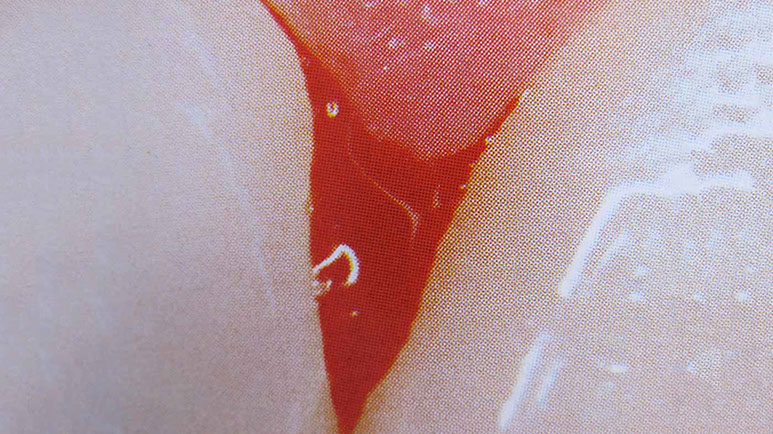 Zahnarztpraxis Dr. Isabel Selmair - München, Schwabing / Parodontitisbehandlung