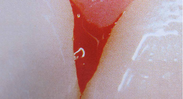 Zahnarztpraxis Dr. Isabel Selmair - München, Schwabing / Parodontitisbehandlung