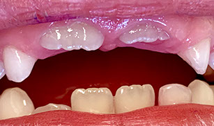 Zahnarztpraxis Dr. Isabel Selmair - München, Schwabing / Kinderzahnheilkunde