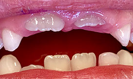 Zahnarztpraxis Dr. Isabel Selmair - München, Schwabing / Kinderzahnheilkunde