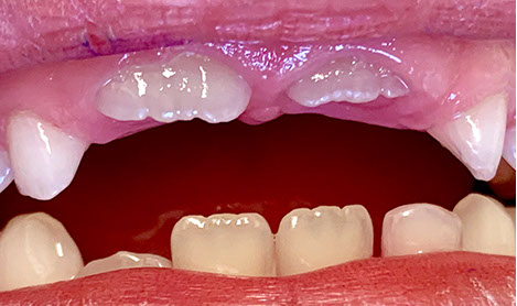 Zahnarztpraxis Dr. Isabel Selmair - München, Schwabing / Kinderzahnheilkunde