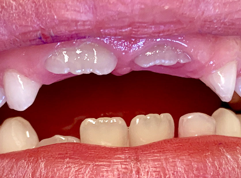 Zahnarztpraxis Dr. Isabel Selmair - München, Schwabing / Kinderzahnheilkunde