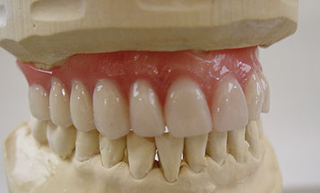 Zahnarztpraxis Dr. Isabel Selmair - München, Schwabing / Zahnersatz, Totalprothese