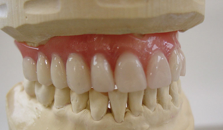 Zahnarztpraxis Dr. Isabel Selmair - München, Schwabing / Alterszahnheilkunde, Zahnreinigung