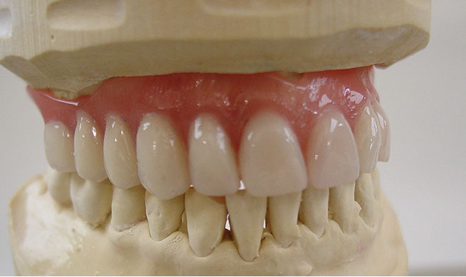 Zahnarztpraxis Dr. Isabel Selmair - München, Schwabing / Alterszahnheilkunde, Zahnreinigung