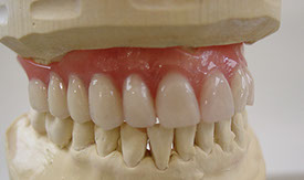 Zahnarztpraxis Dr. Isabel Selmair - München, Schwabing / Alterszahnheilkunde, Zahnreinigung