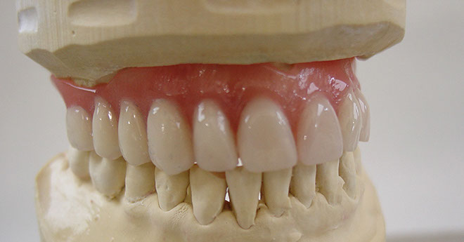 Zahnarztpraxis Dr. Isabel Selmair - München, Schwabing / Zahnersatz, Totalprothese