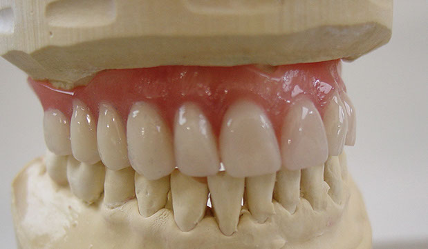 Zahnarztpraxis Dr. Isabel Selmair - München, Schwabing / Alterszahnheilkunde, Zahnreinigung