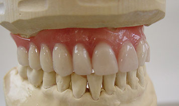 Zahnarztpraxis Dr. Isabel Selmair - München, Schwabing / Alterszahnheilkunde, Zahnreinigung