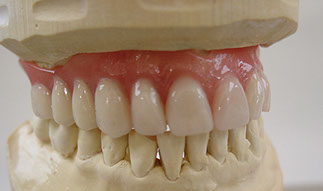 Zahnarztpraxis Dr. Isabel Selmair - München, Schwabing / Alterszahnheilkunde, Zahnreinigung