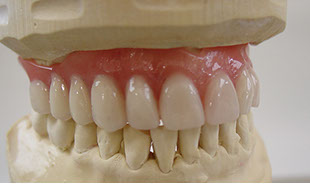 Zahnarztpraxis Dr. Isabel Selmair - München, Schwabing / Alterszahnheilkunde, Zahnreinigung