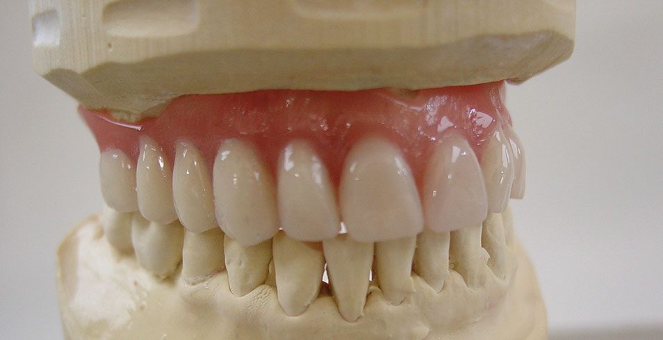 Zahnarztpraxis Dr. Isabel Selmair - München, Schwabing / Alterszahnheilkunde, Zahnreinigung