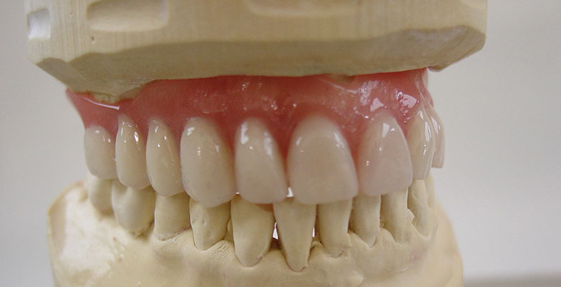 Zahnarztpraxis Dr. Isabel Selmair - München, Schwabing / Zahnersatz, Totalprothese