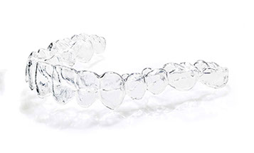 Zahnarztpraxis Dr. Isabel Selmair - München, Schwabing / Schienentherapie, Aligner Therapie