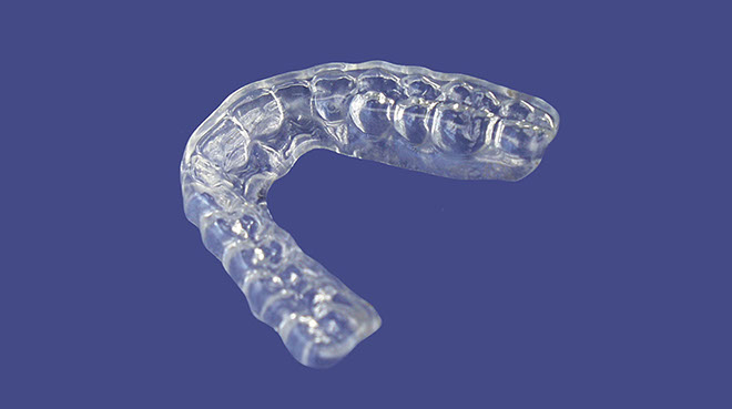 Zahnarztpraxis Dr. Isabel Selmair - München, Schwabing / Schienentherapie, Zähneknirschen