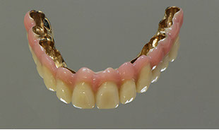 Zahnarztpraxis Dr. Isabel Selmair - München, Schwabing / Alterszahnheilkunde, Zahnersatz