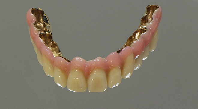 Zahnarztpraxis Dr. Isabel Selmair - München, Schwabing / Alterszahnheilkunde, Zahnreinigung