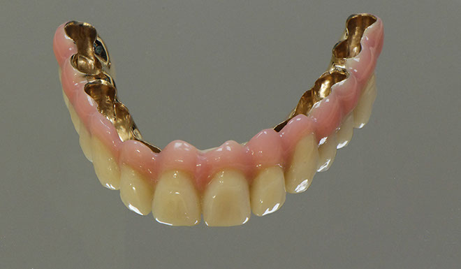 Zahnarztpraxis Dr. Isabel Selmair - München, Schwabing / Alterszahnheilkunde, Zahnersatz