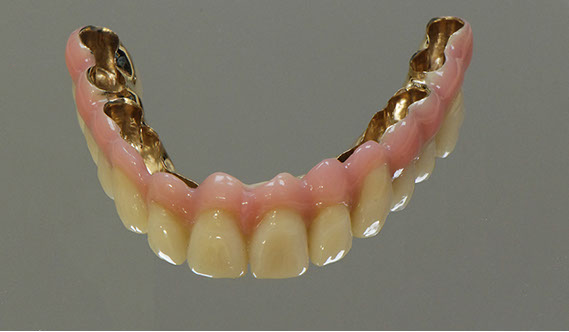 Zahnarztpraxis Dr. Isabel Selmair - München, Schwabing / Alterszahnheilkunde, Zahnersatz