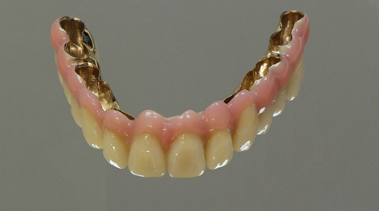 Zahnarztpraxis Dr. Isabel Selmair - München, Schwabing / Alterszahnheilkunde, Zahnreinigung