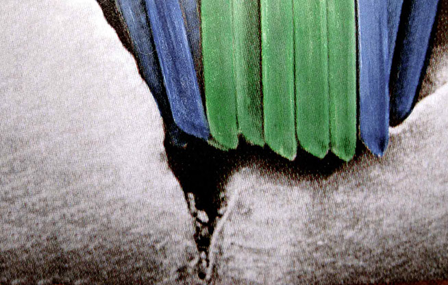 Zahnarztpraxis Dr. Isabel Selmair - München, Schwabing / Vorsorge Prophylaxe, Fissuren und Versiegelungen