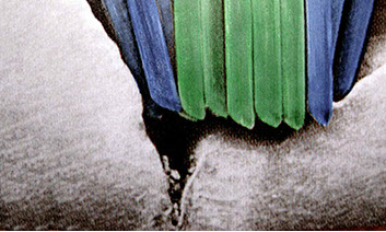 Zahnarztpraxis Dr. Isabel Selmair - München, Schwabing / Vorsorge Prophylaxe, Fissuren und Versiegelungen